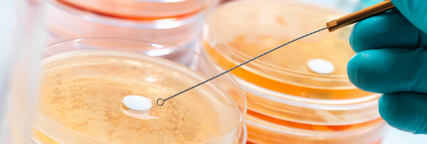 方法學(xué)驗(yàn)證試驗(yàn)