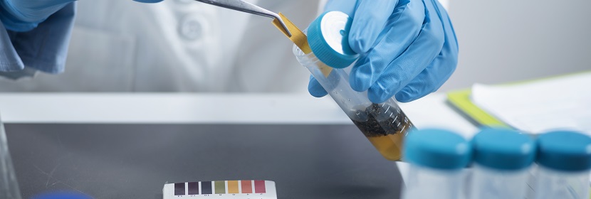 體外哺乳動物細(xì)胞基因突變試驗(yàn)