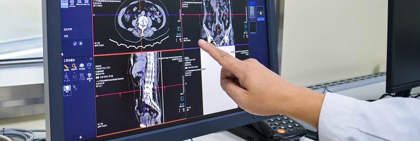 工業(yè)CT無損檢測