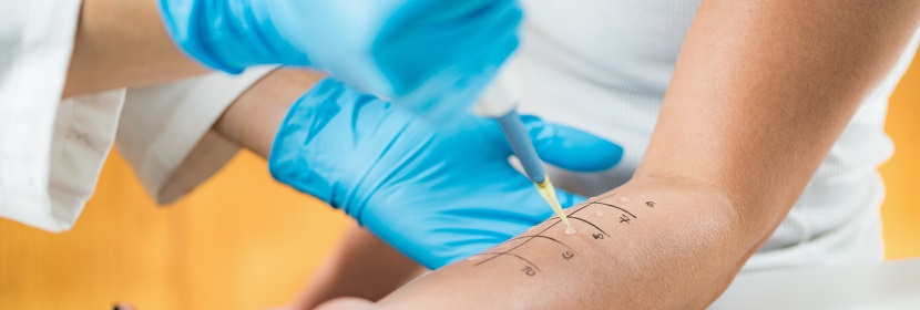 化學(xué)品急性皮膚刺激性/腐蝕性試驗