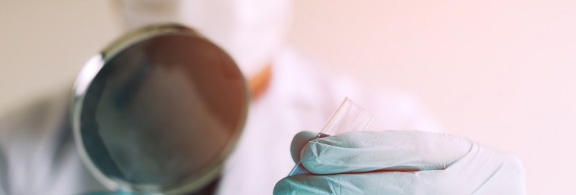 雙面多楔帶檢測(cè)