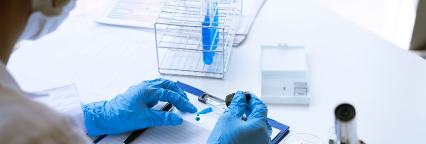 動力鋰電池用橡膠密封件檢測